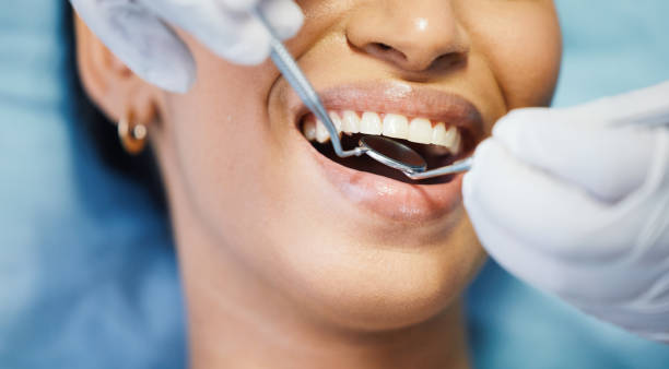 Best Emergency Treatment for Dental Infections or Abscesses in Wilder, ID